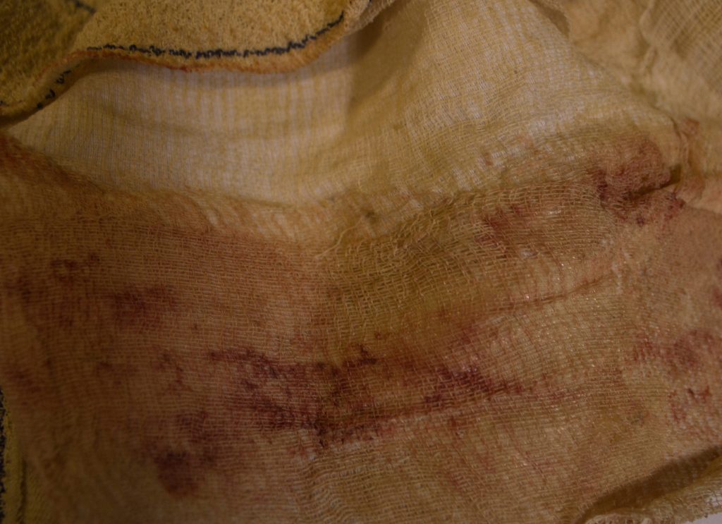 Costume de blessé Décoration plaie suintante brulure